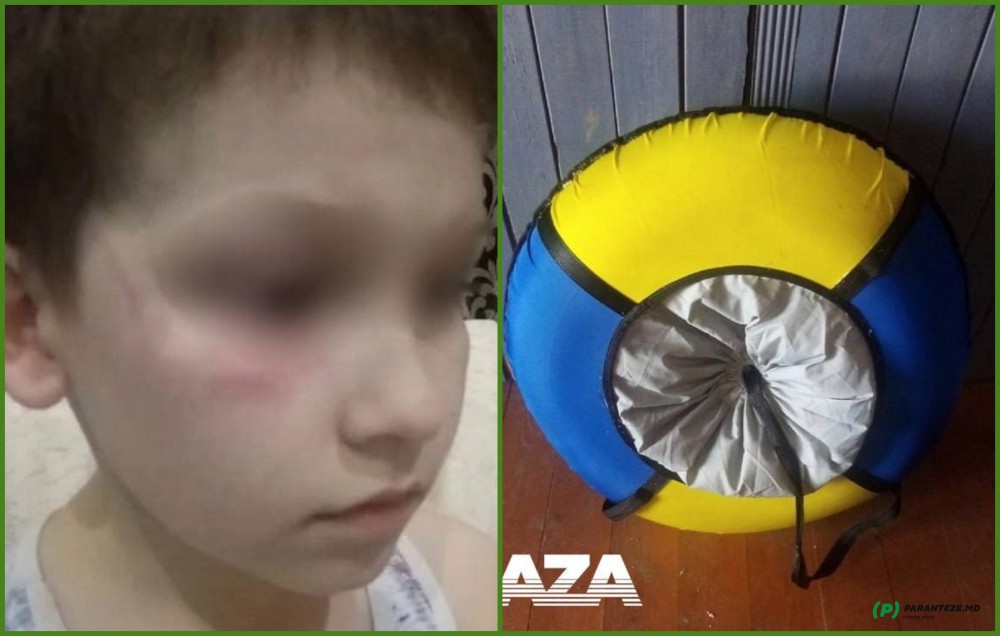 FOTO // Caz revoltător în Rusia. Un copil a fost bătut pentru că a ieșit afară cu o sanie galbenă-albastră